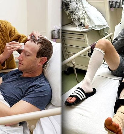 Mark Zuckerberg, Dövüş Antrenmanında Geçirdiği Kaza Sonucu Ameliyat Oldu